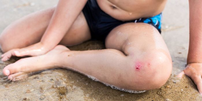 Kleine Wunde, großer Schmerz: Wann nach Baden im Meer zum ...